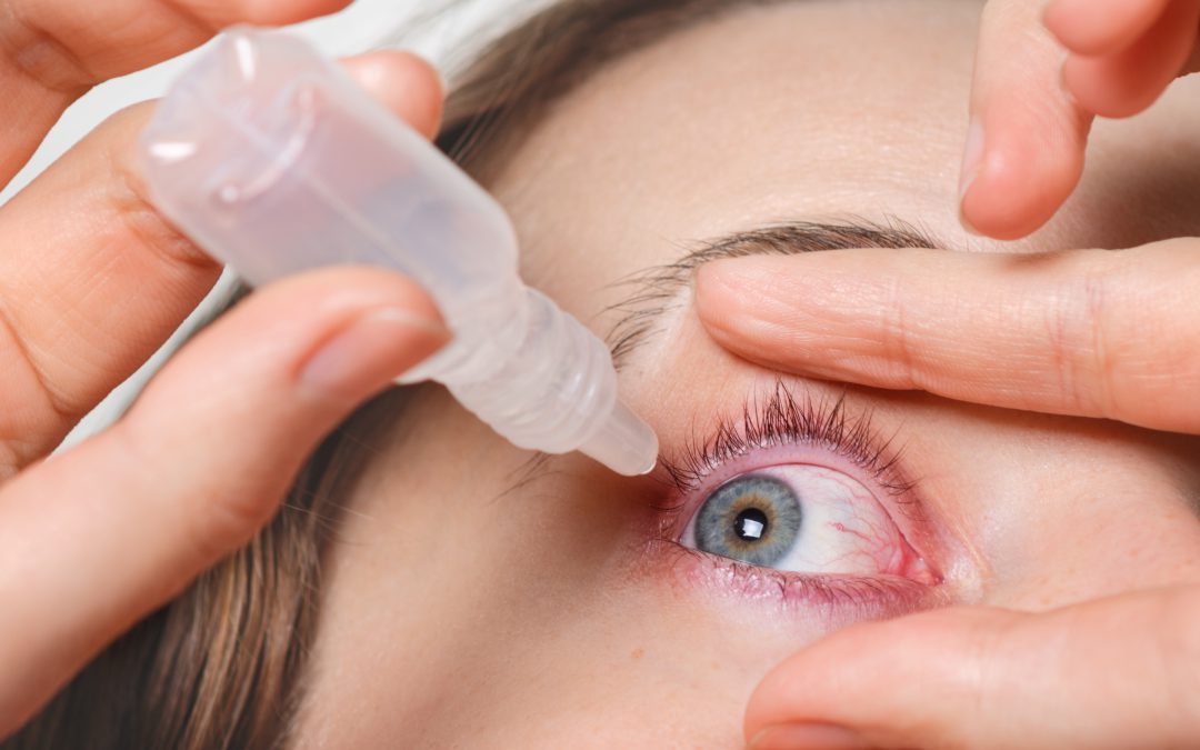Tratamientos Actuales para la Uveítis: Medicación, Inyecciones y Cirugía