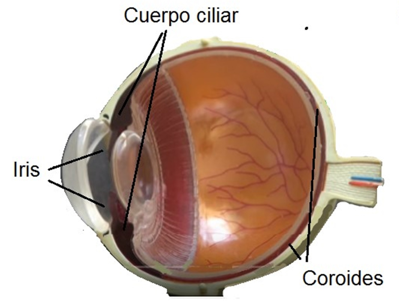 uveitis